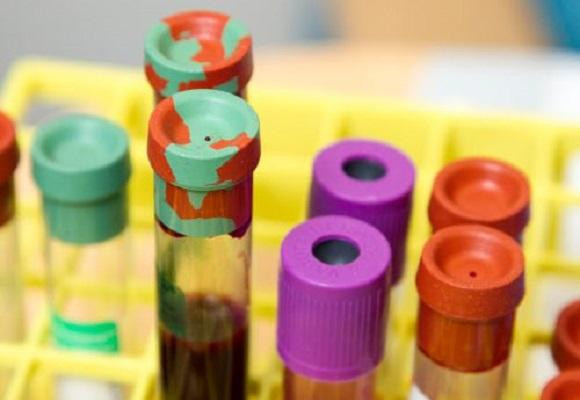 Acompanhamento Exames Laboratoriais